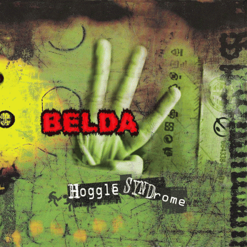 Belda : Hoggle Syndrome